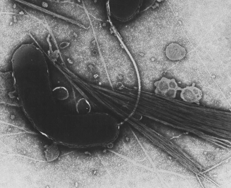 Cholera